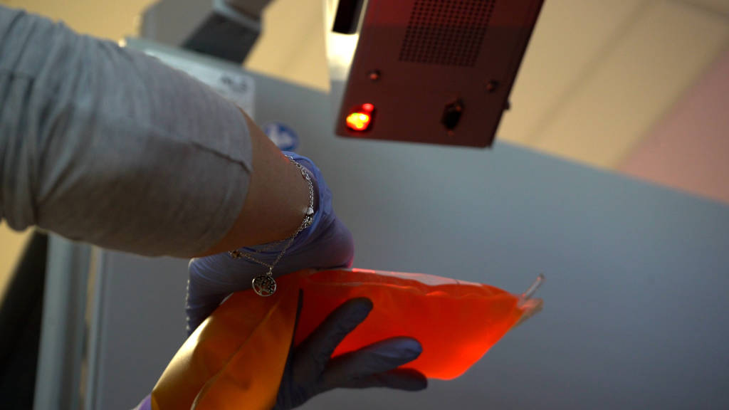La ricerca sul Plasma Iperimmune a Varese